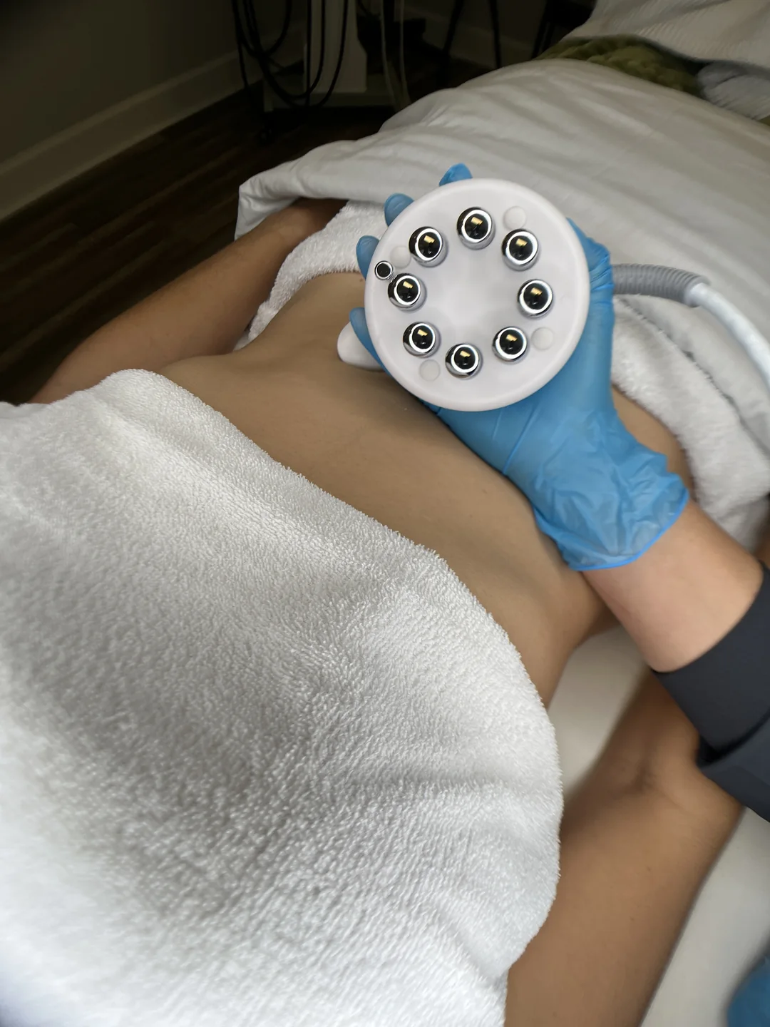Body contouring device on the abdomen at Bambu Recovery